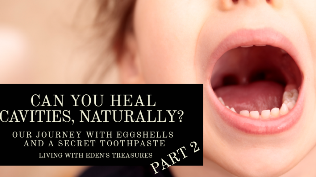 Can You Heal Cavities, Naturally? Part 2